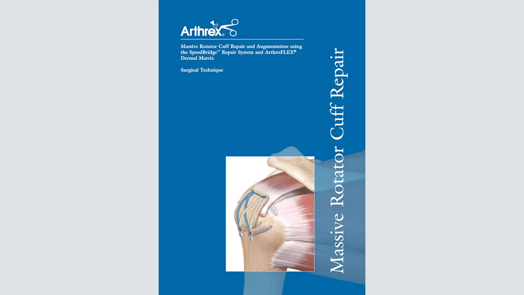 Massive Rotator Cuff Repair and Augmentation using the SpeedBridge™ and ArthroFlex® Dermal Matrix