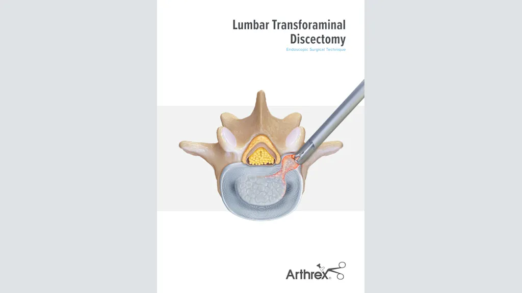 Lumbar Transforaminal Discectomy