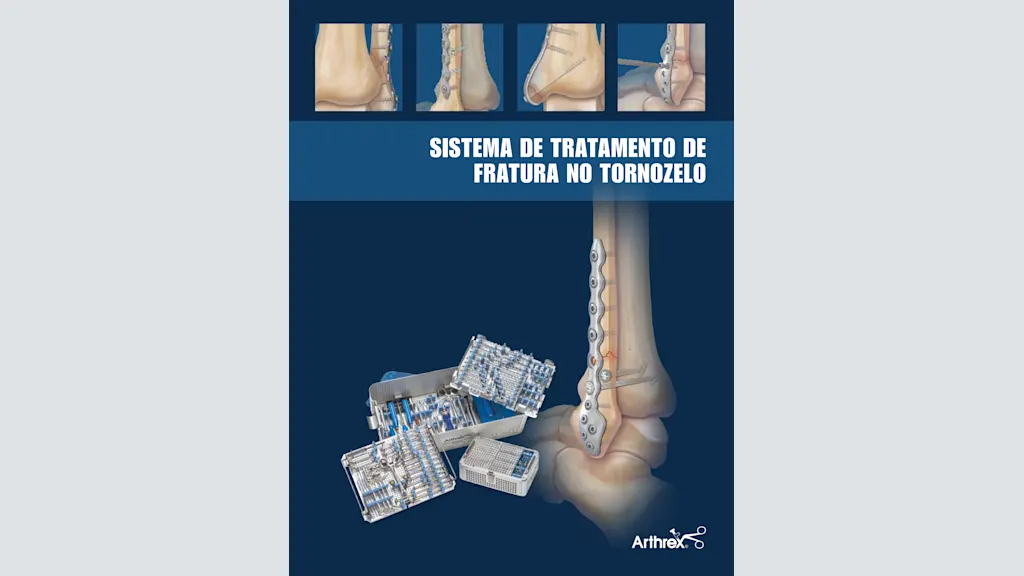 Sistema de tratamento de fratura no tornozelo
