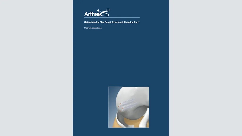Osteochondral Flap Repair System mit Chondral Dart™