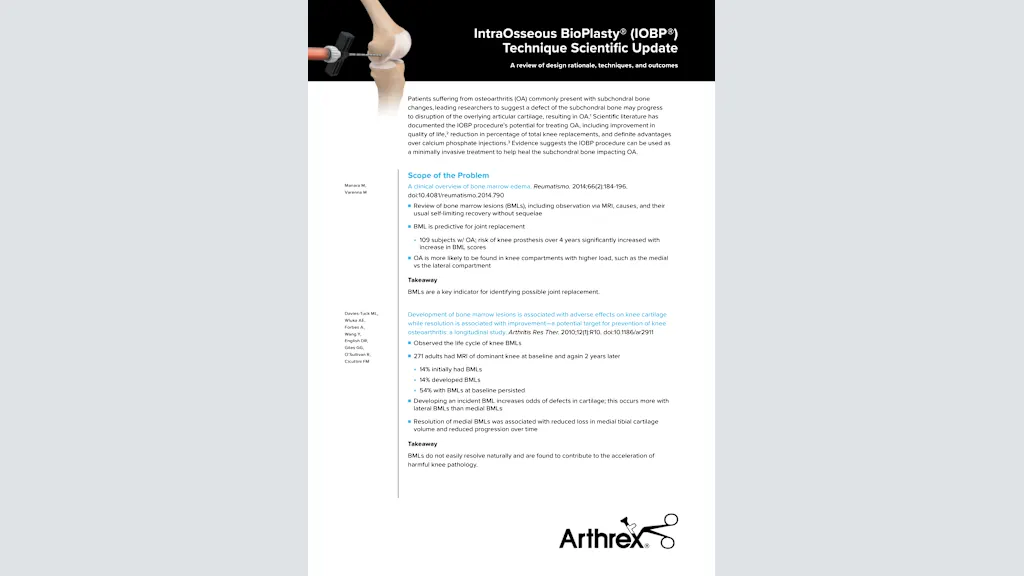IntraOsseous BioPlasty® (IOBP®) Technique Scientific Update