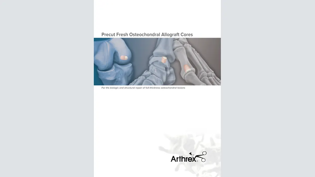Precut Fresh Osteochondral Allograft Cores