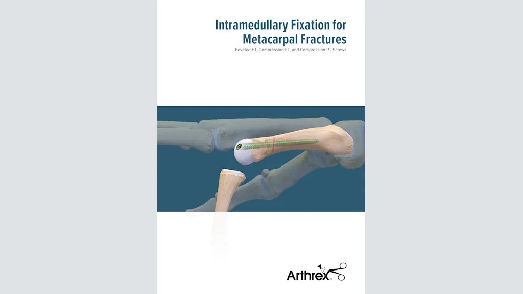 Intramedullary Fixation for Metacarpal Fractures