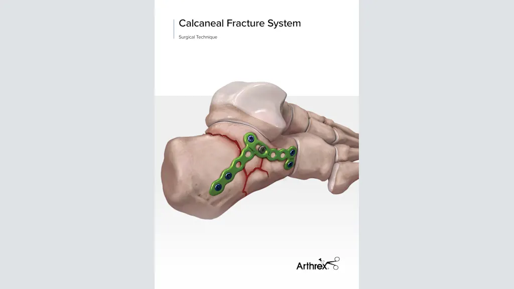 Calcaneal Fracture System