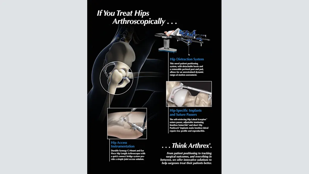 If You Treat Hips Arthroscopically...Think Arthrex