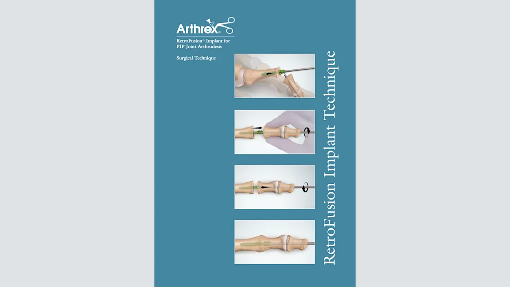 RetroFusion™ Implant for PIP Joint Arthrodesis