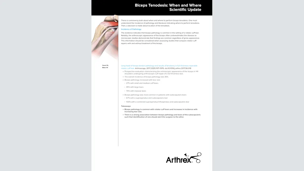 Biceps Tenodesis: When and Where Scientific Update