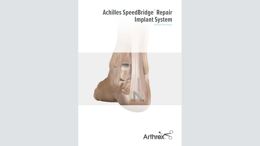 Achilles SpeedBridge™ Repair Implant System