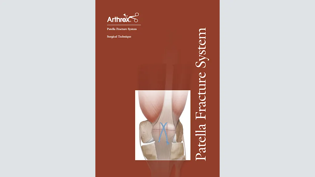 Patella Fracture System