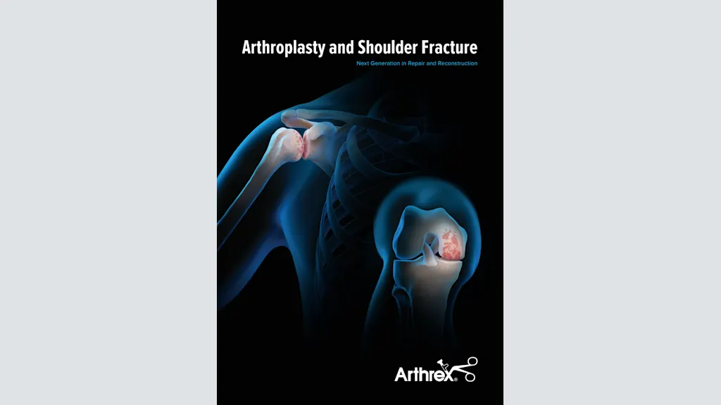 Arthroplasty and Shoulder Fracture - Next Generation in Repair and Reconstruction