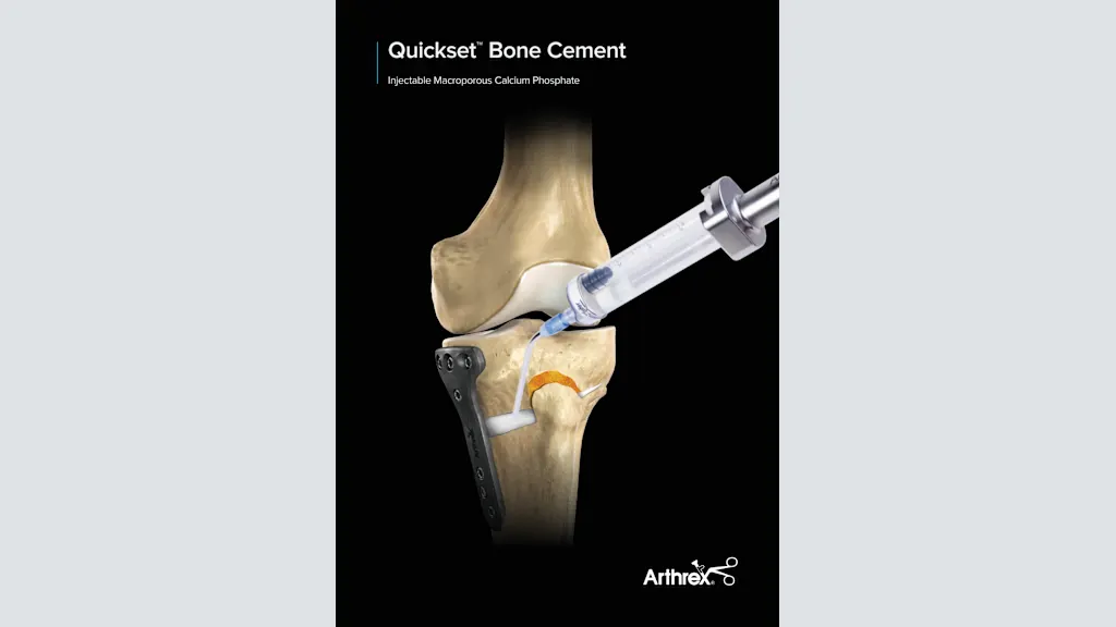 Quickset™ Bone Cement - Injectable Macroporous Calcium Phosphate