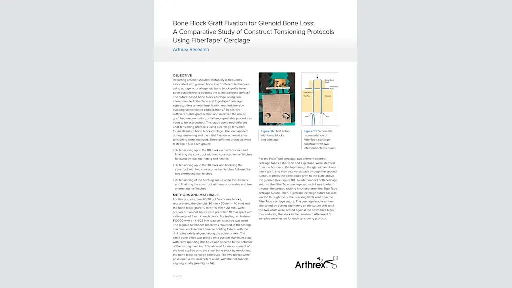 Bone Block Graft Fixation for Glenoid Bone Loss: A Comparative Study of Construct Tensioning Protocols Using FiberTape® Cerclage