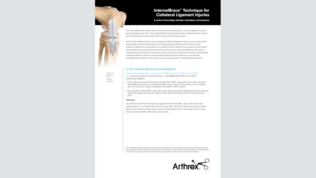 InternalBrace™ Technique for Collateral Ligament Injuries