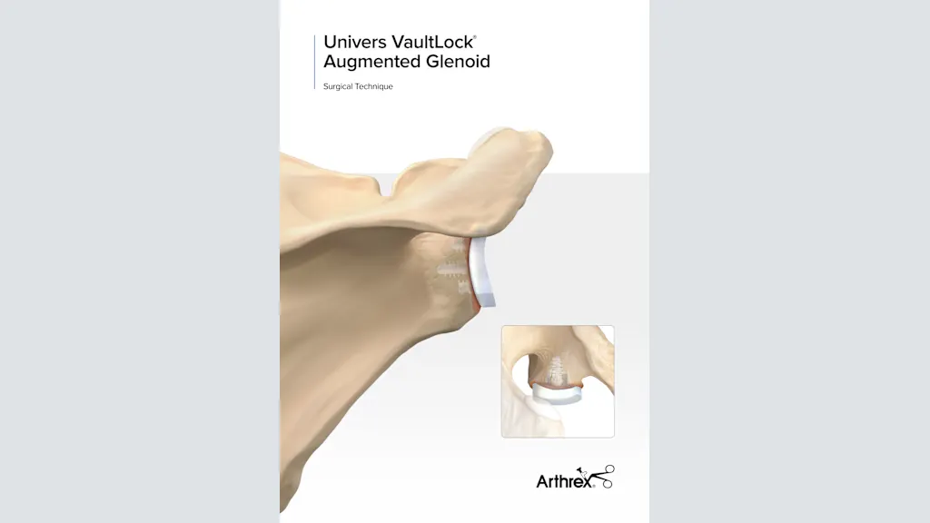 Univers VaultLock® Augmented Glenoid