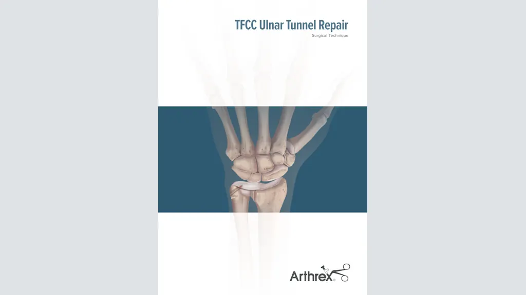 TFCC Ulnar Tunnel Repair