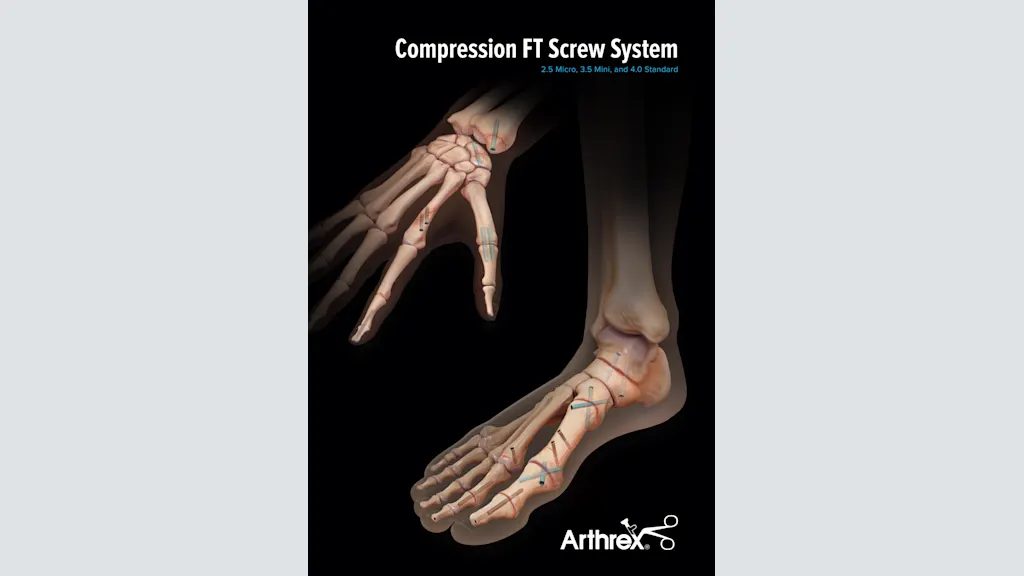 Compression FT Screw System