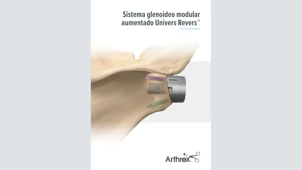 Sistema glenoideo modular aumentado Univers Revers™