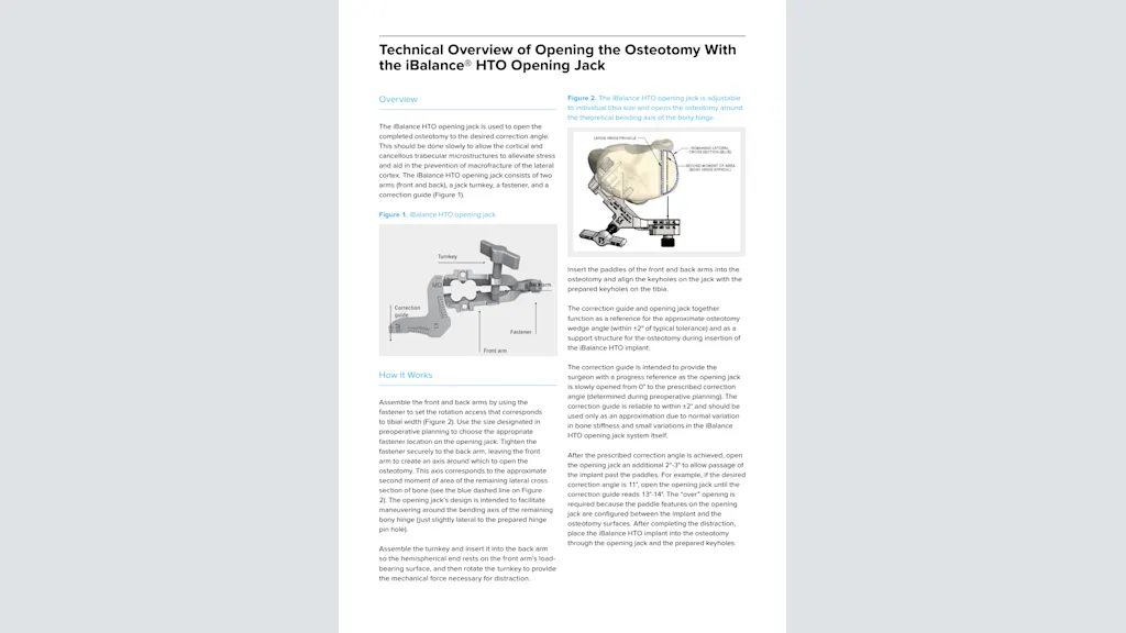 Technical Overview of Opening the Osteotomy With the iBalance® HTO Opening Jack