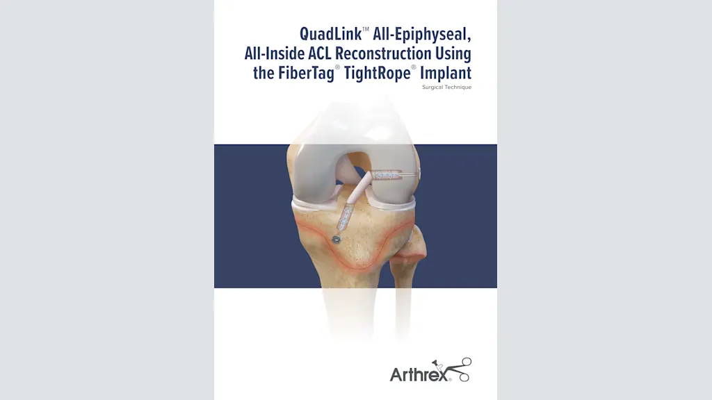 QuadLink™ All-Epiphyseal, All-Inside ACL Reconstruction Using  the FiberTag® TightRope® Implant