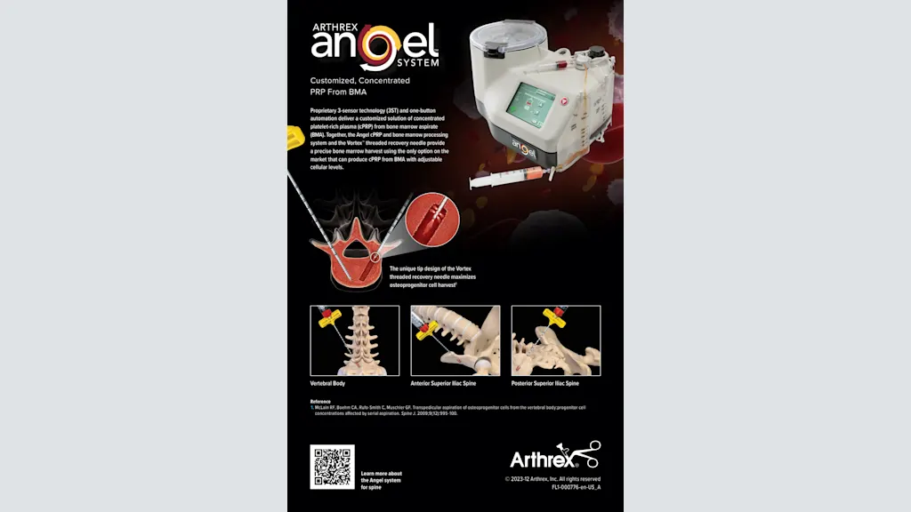 Arthrex Angel System - Customized, Concentrated PRP From BMA