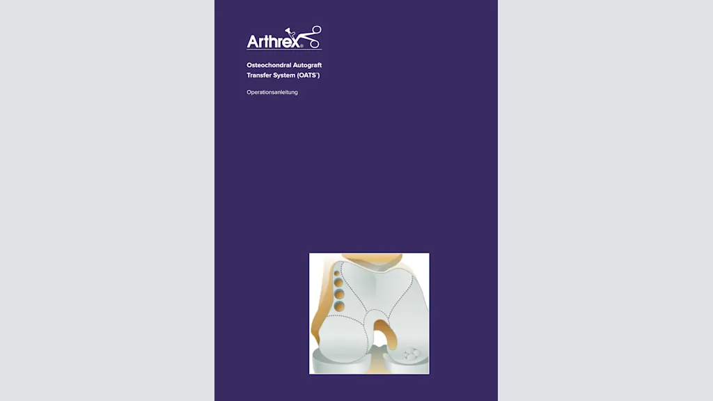 Osteochondral Autograft Transfer System (OATS®)