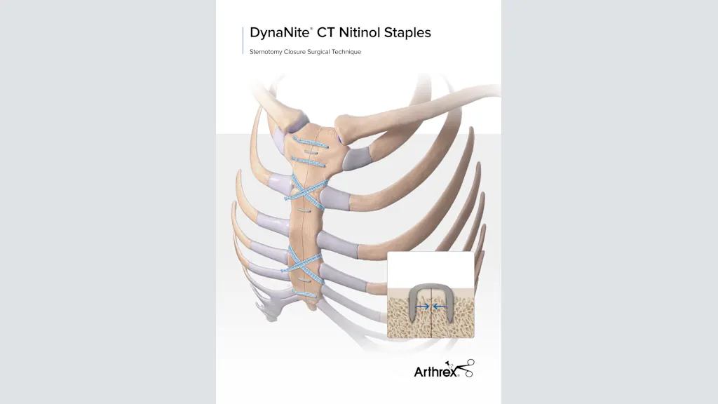 DynaNite® CT Nitinol Staples Sternotomy Closure Surgical Technique