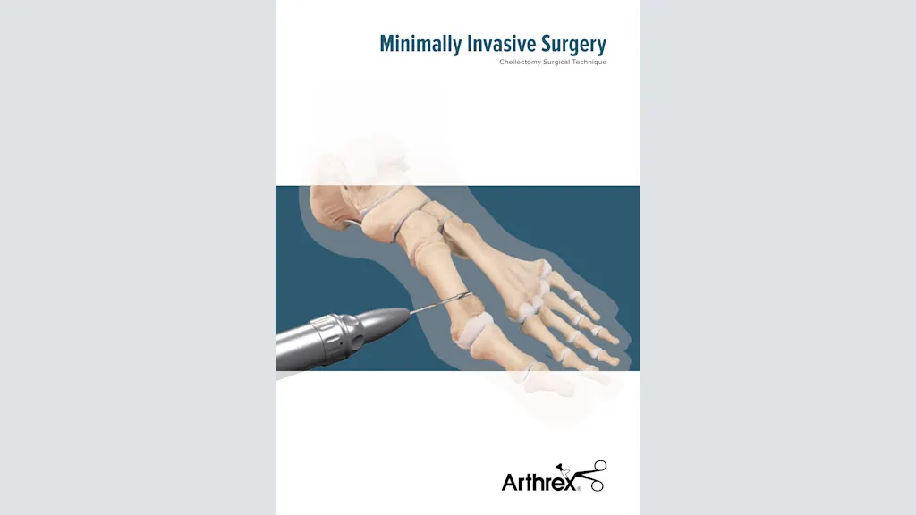 Minimally Invasive Surgery - Cheilectomy Surgical Technique