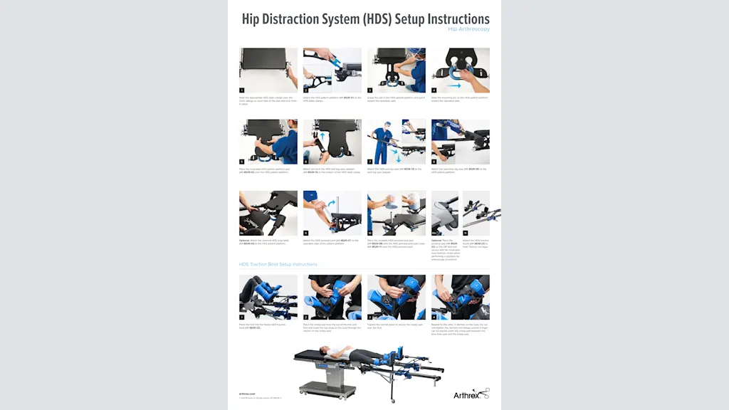 Hip Distraction System (HDS) Setup Instructions