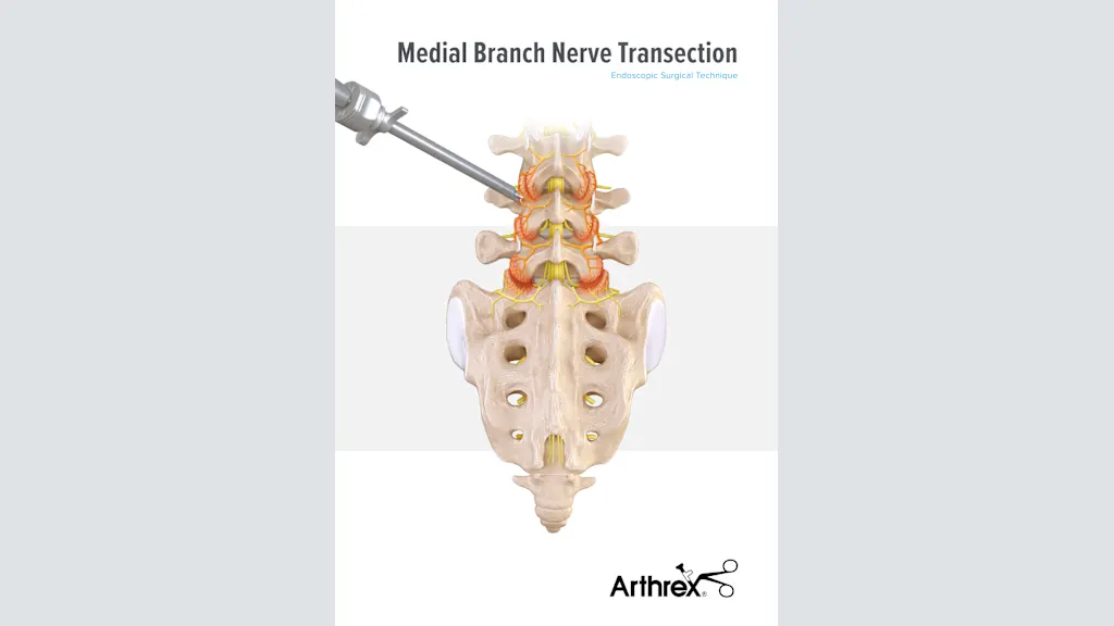 Medial Branch Nerve Transection