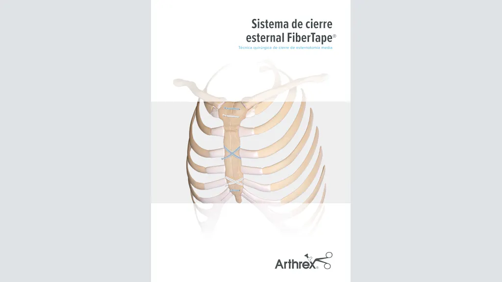 Sistema de cierre esternal FiberTape®