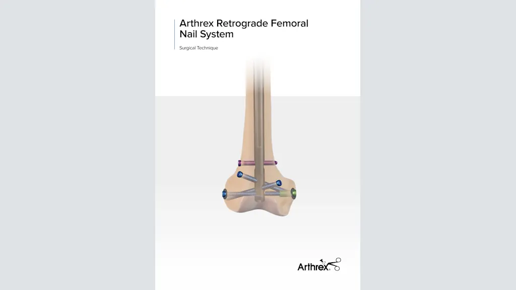 Arthrex - Retrograde Femoral Nail System