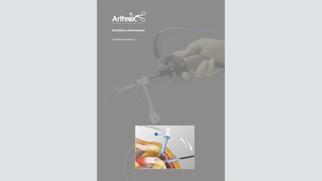 Schaftlose Arthroskopie
