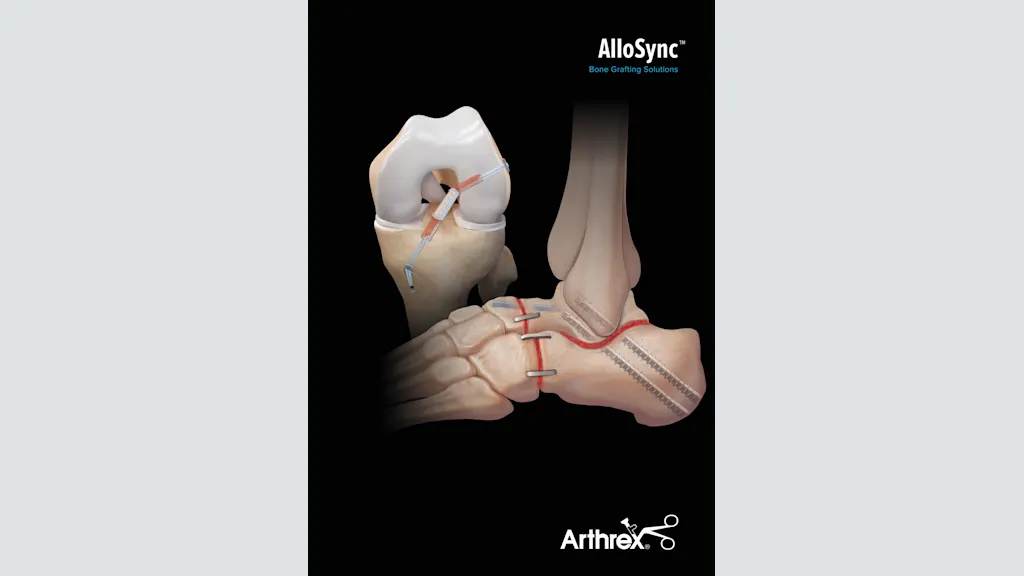 AlloSync™ Bone Grafting Solutions