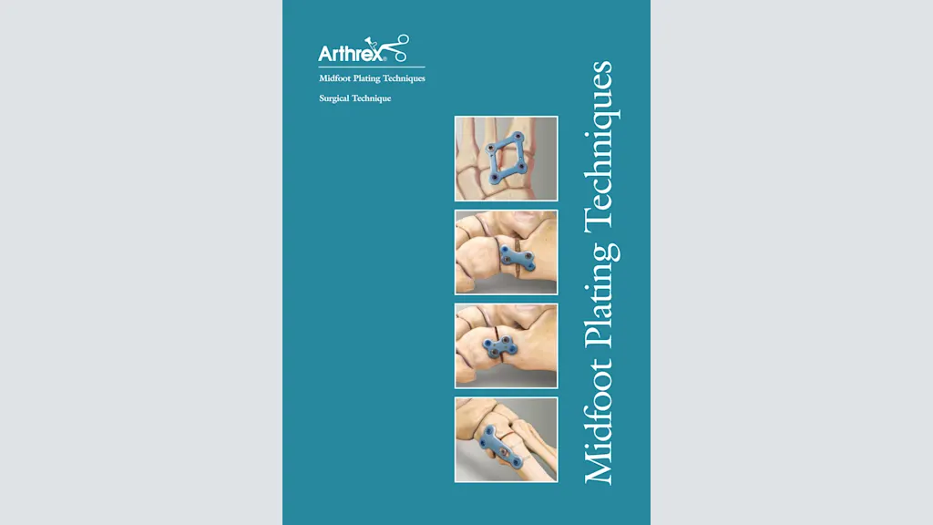 Midfoot Plating Techniques