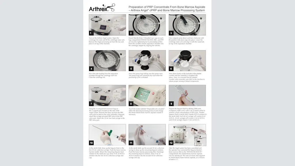 Preparation of PRP Concentrate From Bone Marrow Aspirate – Arthrex Angel® cPRP and Bone Marrow Processing System