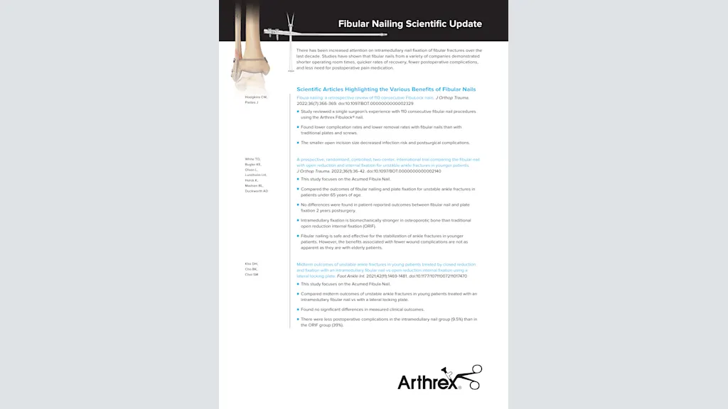 Fibular Nailing Scientific Update