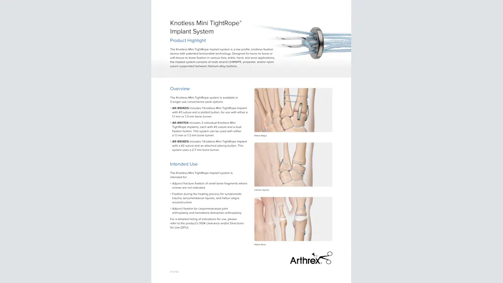 Knotless Mini TightRope® Implant System