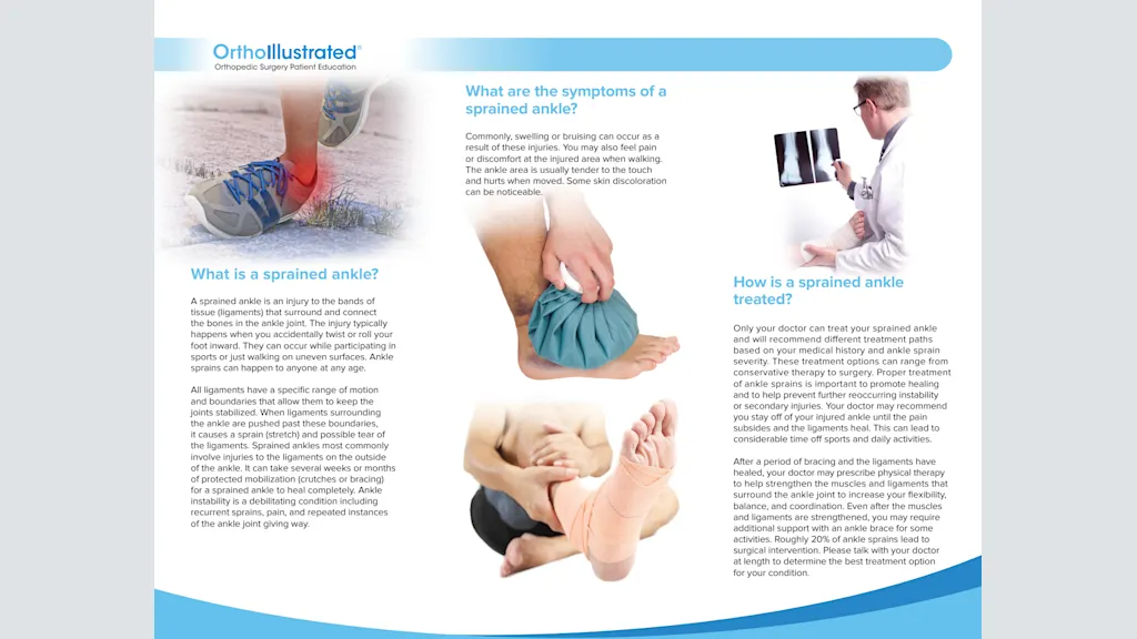 InternalBrace™ Ligament Augmentation