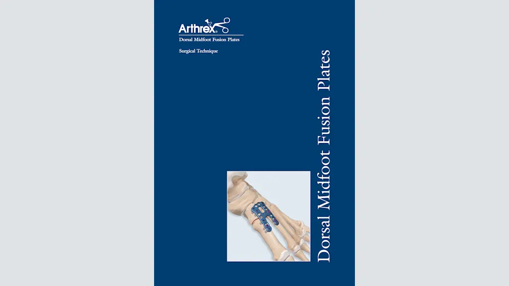 Dorsal Midfoot Fusion Plates