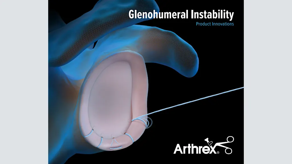 Glenohumeral Instability Product Innovations