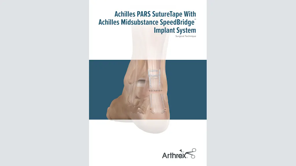 Achilles PARS SutureTape With Achilles Midsubstance SpeedBridge™ Implant System