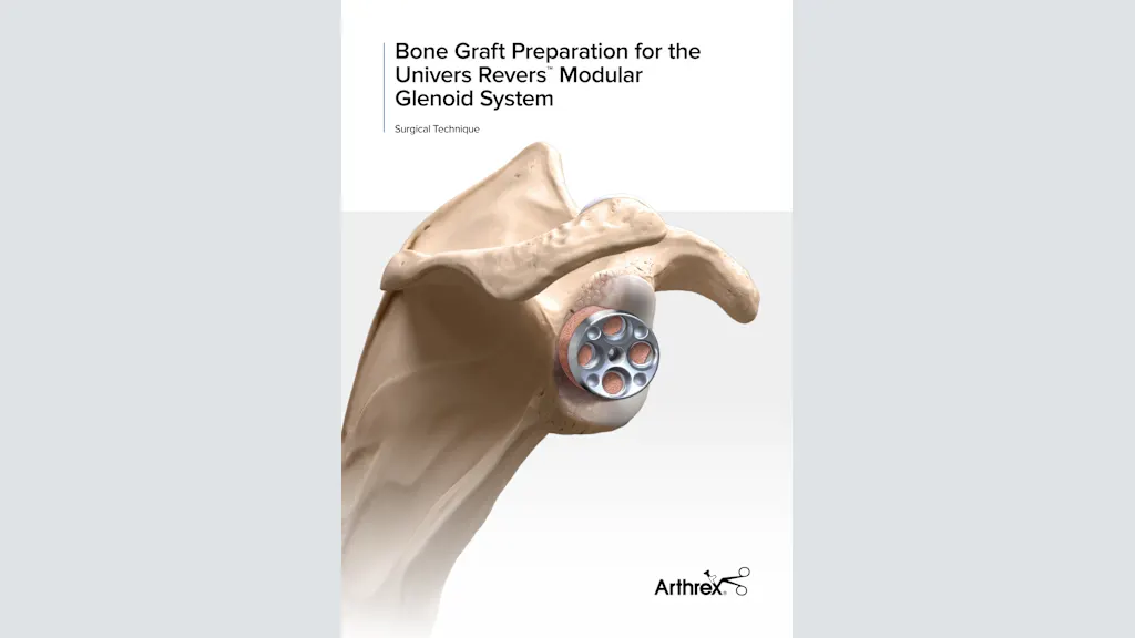 Bone Graft Preparation for the Univers Revers™ Modular Glenoid System