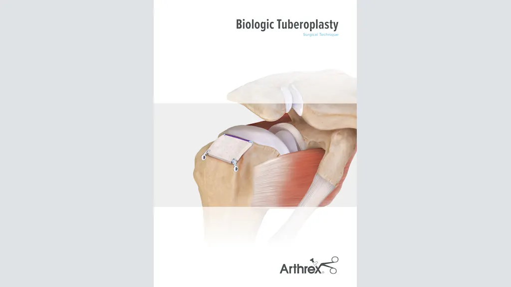 Biologic Tuberoplasty