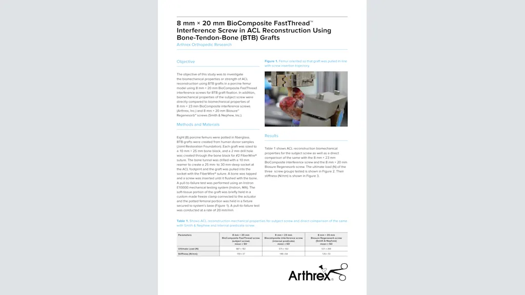 8 mm × 20 mm BioComposite FastThread™ Interference Screw in ACL Reconstruction Using Bone-Tendon-Bone (BTB) Grafts