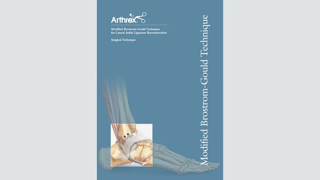 Modified Brostrom-Gould Technique for Lateral Ankle Ligament Reconstruction