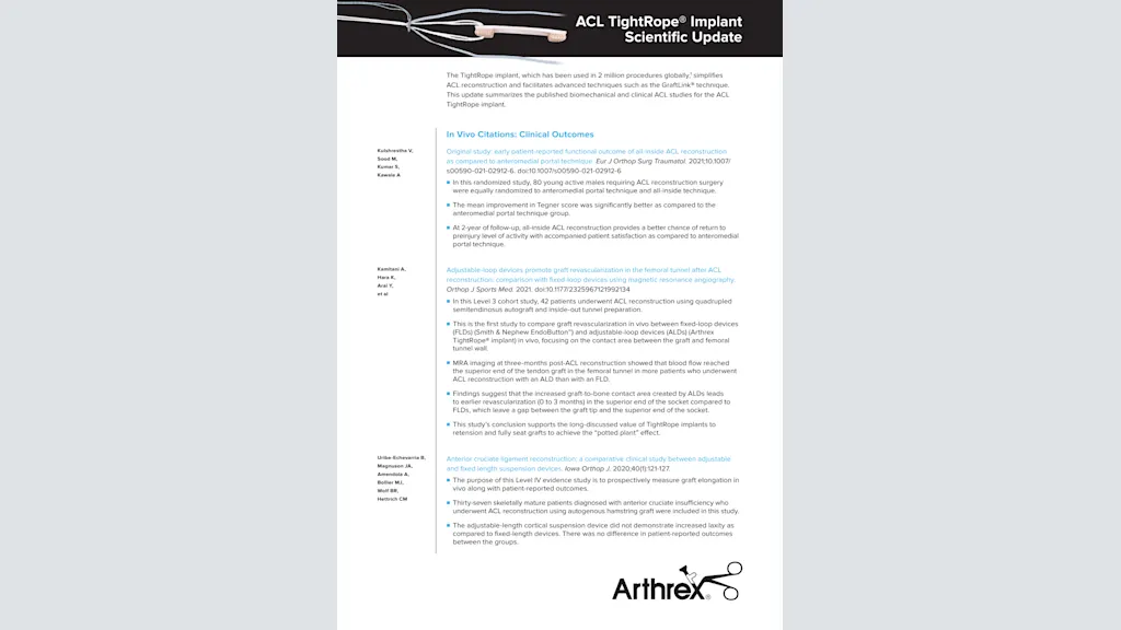 ACL TightRope® Implant Scientific Update