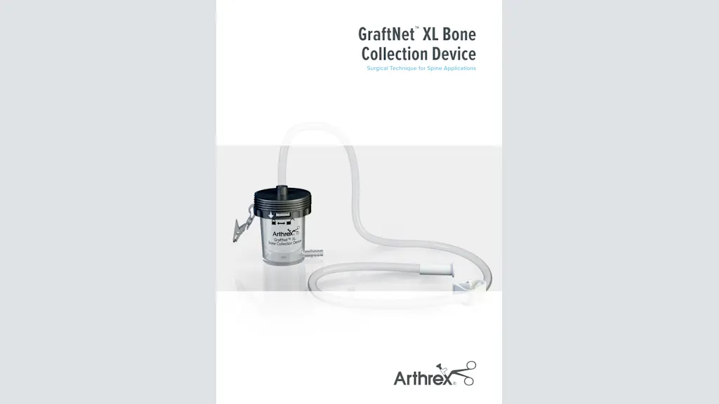 GraftNet™  XL Bone Collection Device - Surgical Technique for Spine Applications