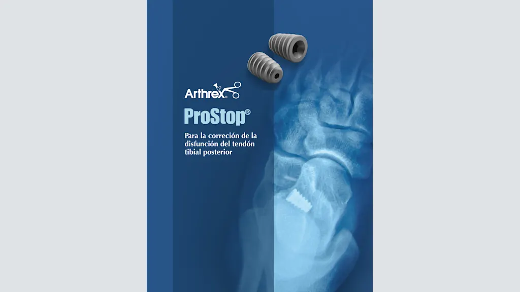 ProStop® - Para la correción de la disfunción del tendón tibial posterior