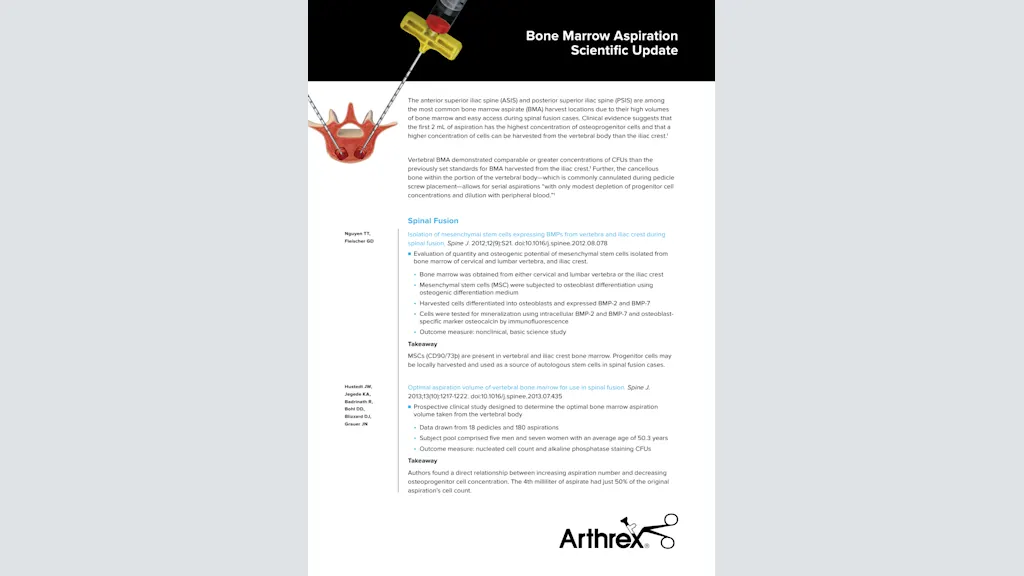 Bone Marrow Aspiration Scientific Update