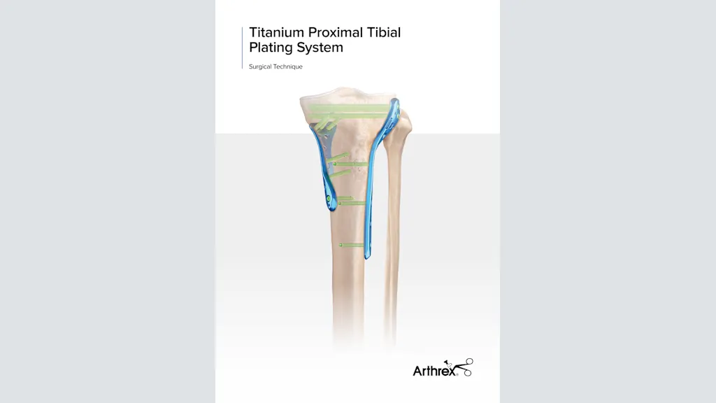 Titanium Proximal Tibial Plating System